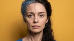 Wie bekommt man wieder straffe Haut?